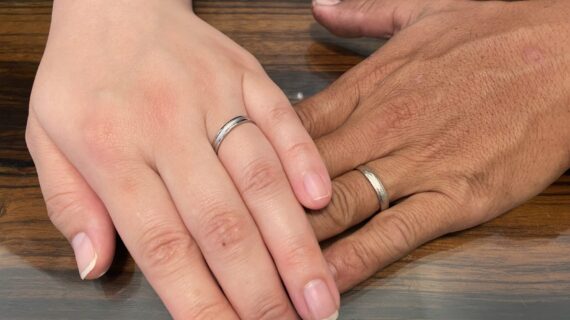 フィッシャーの結婚指輪を着けたカップル