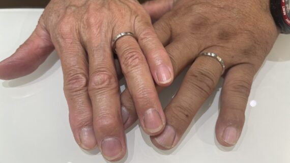 サムシングブルーの指輪を着けた夫婦