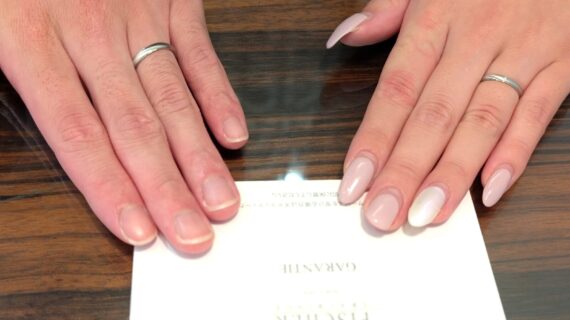 フィッシャーの結婚指輪をつけたカップル