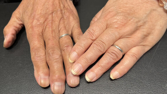 ノクルの結婚指輪を着けたご夫婦